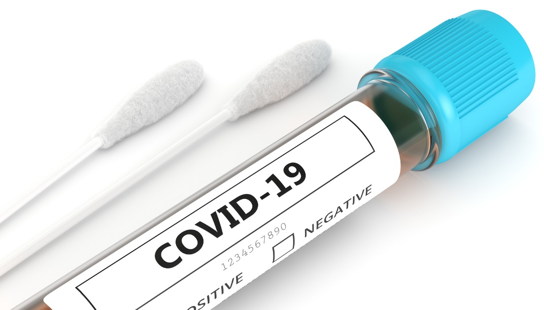 Corona Vírus - COVID-19